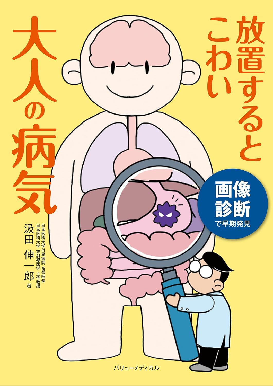 画像診断で早期発見 放置するとこわい大人の病気