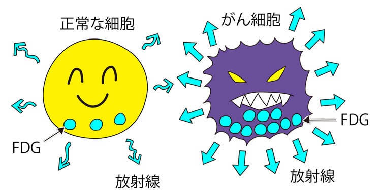 正常な細胞とがん細胞が放つ放射線の違い