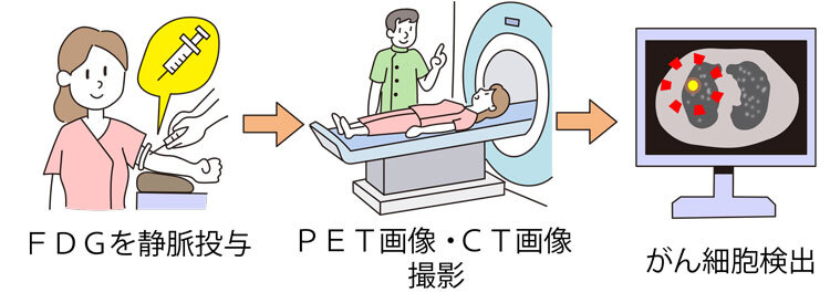 PET検査の流れ
