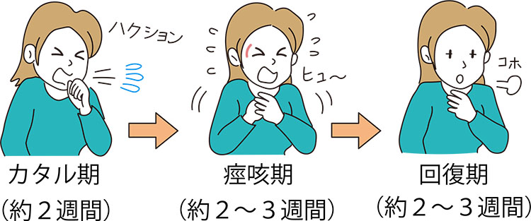 図:百日咳の経過(カタル期(約2週間)・痙咳期(約2~3週間)・回復期(役2~3週間))