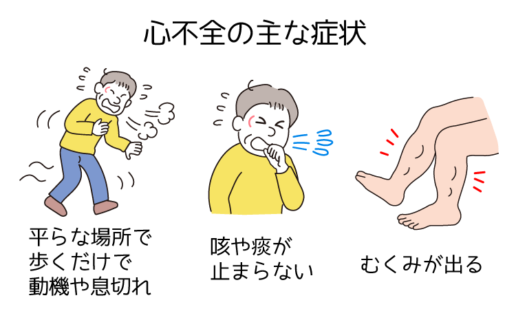図:心不全の主な症状。平らな場所で歩くだけで動機や息切れ。咳や痰が止まらない。むくみが出る。