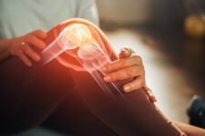 高精度な操作による人工膝関節置換術