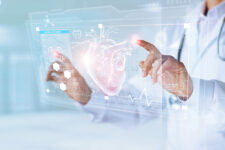 虚血性心疾患と弁膜症への迅速・適切なカテーテル治療