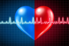 MICS：僧帽弁閉鎖不全症、大動脈弁閉鎖不全症に対する低侵襲手術