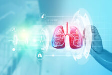 原発性肺がんの外科治療とは?