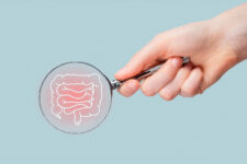 大腸がんの内科的・外科的治療