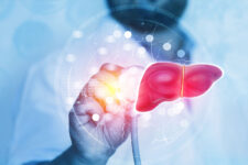 胆道・膵臓がんに対する内科的治療