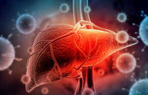 さまざまな原因に応じた慢性肝炎の治療