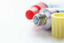 アトピー性皮膚炎に対する新しい治療