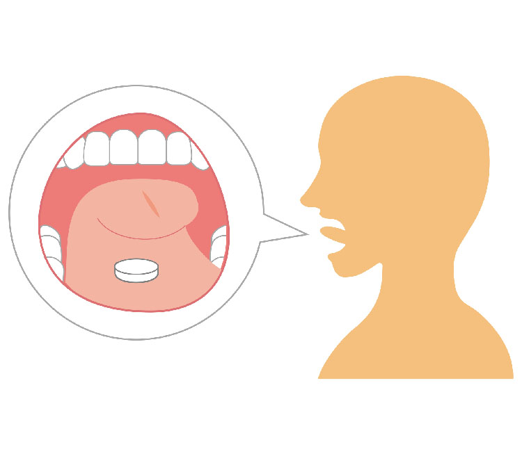 図：薬を舌の下で溶かして飲みこむ