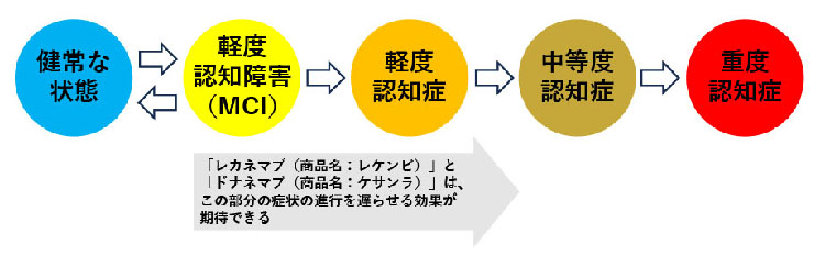 図：健常な状態⇔軽度認知障害（MCI）→軽度認知症→中等度認知症→重度認知症