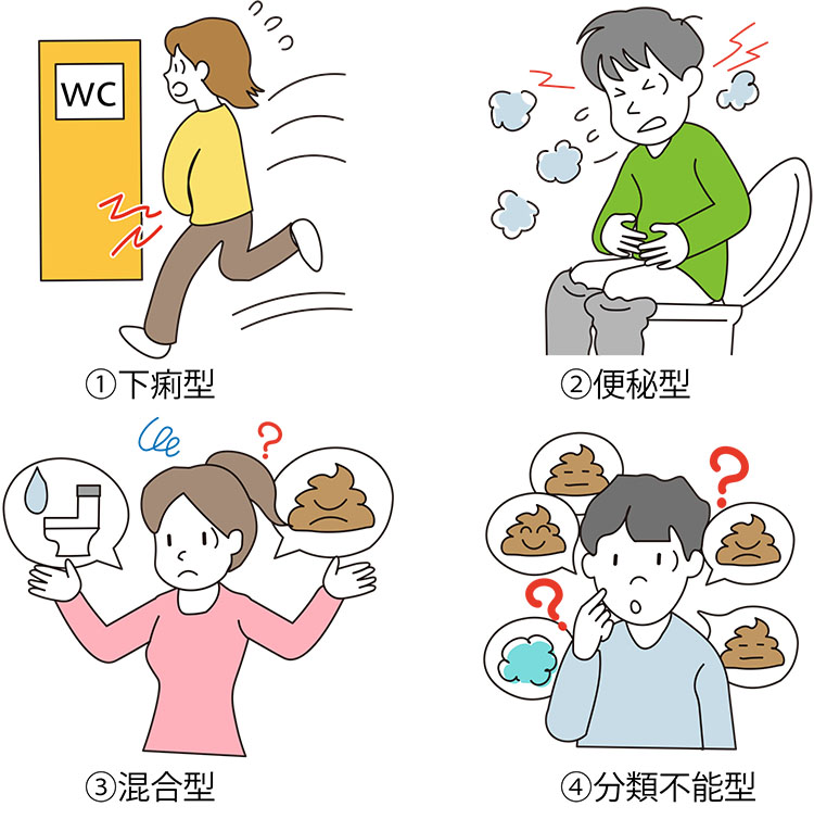 図:過敏性腸症候群の4タイプ。①下痢型・②便秘型・③混合型・④分類不能型