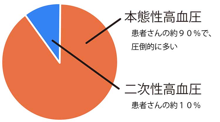 グラフ：本態性高血圧と二次性高血圧の割合を示す円グラフ。本態性高血圧が全体の90%で圧倒的に多い。