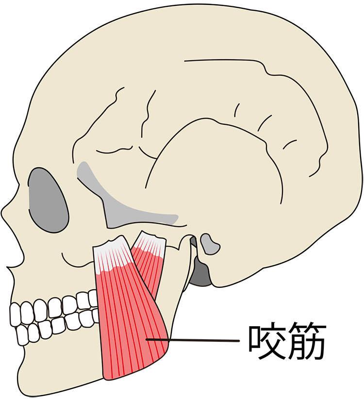 イラスト：咬筋が過剰に働く