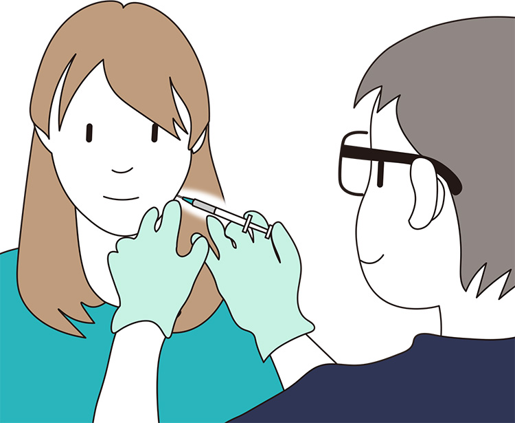 イラスト：咬筋へのボトックス注射の施術イメージ