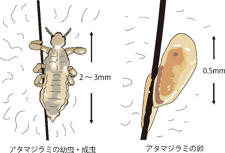 イラスト：アタマジラミの成虫と卵