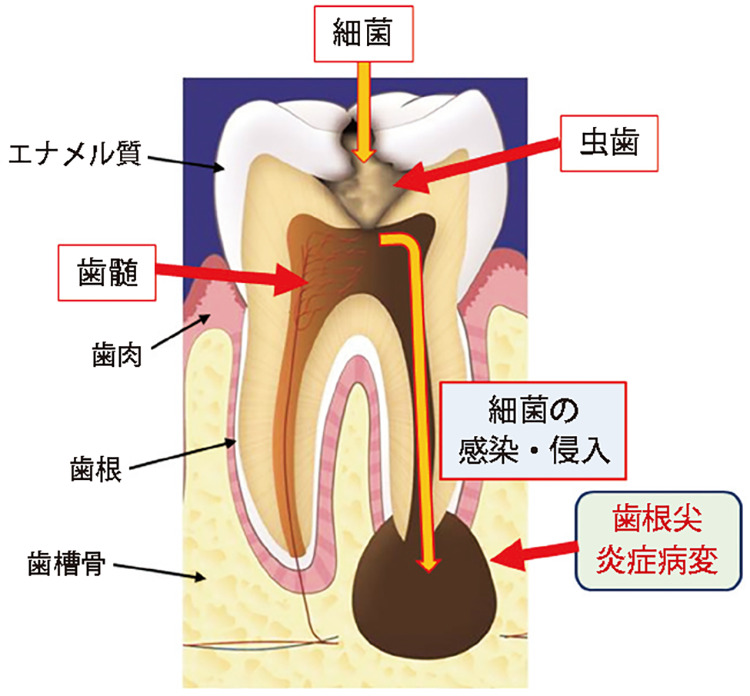 イラスト