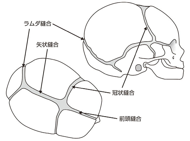 赤面症の原因は何ですか?