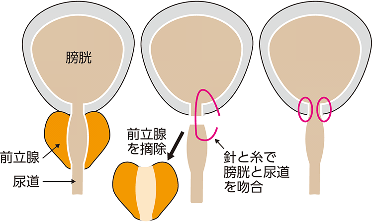 図