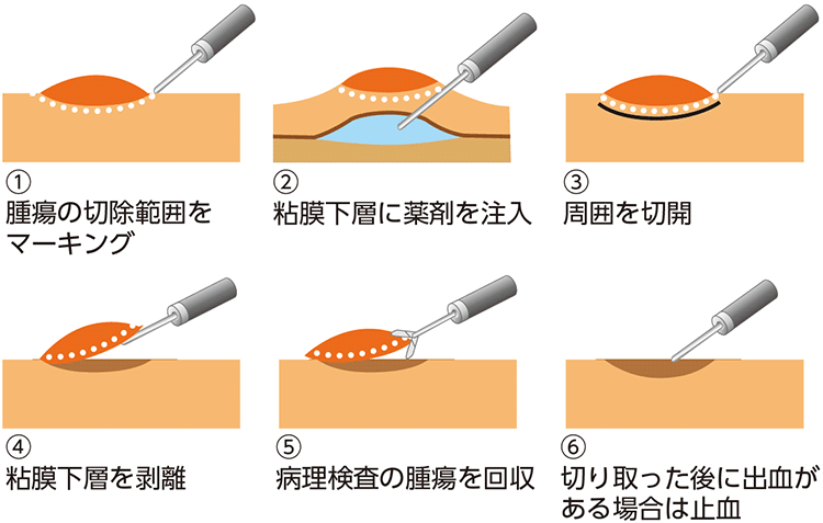 図