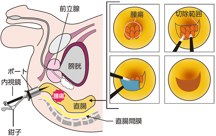 図