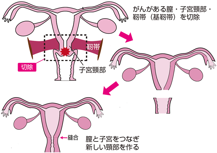 図