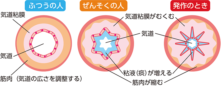 図