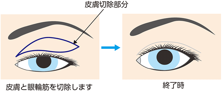 図