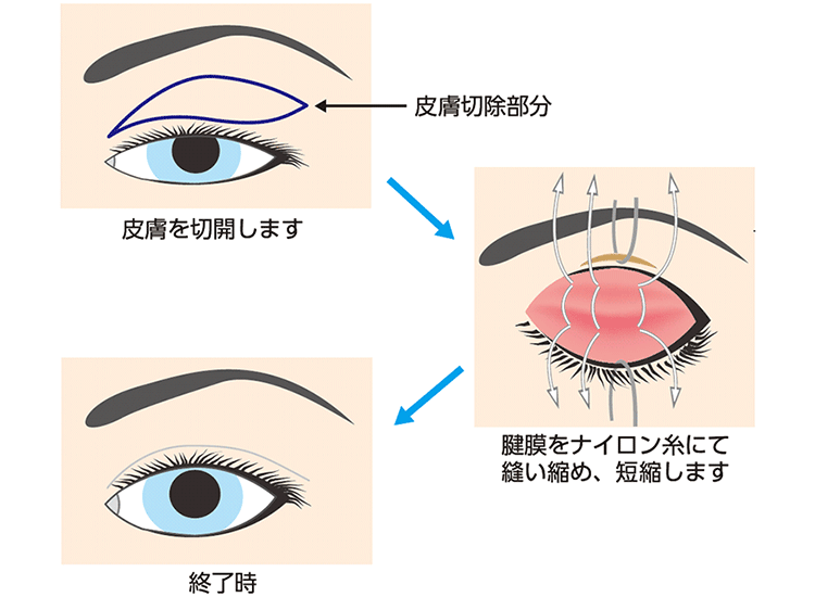 図