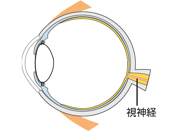 図