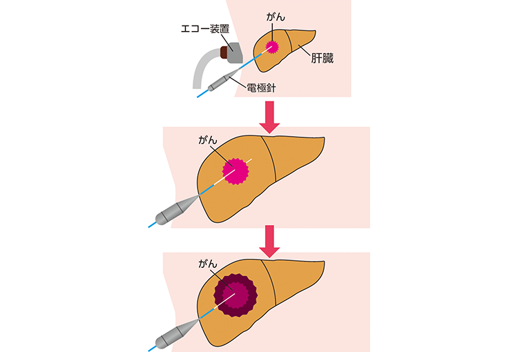 図