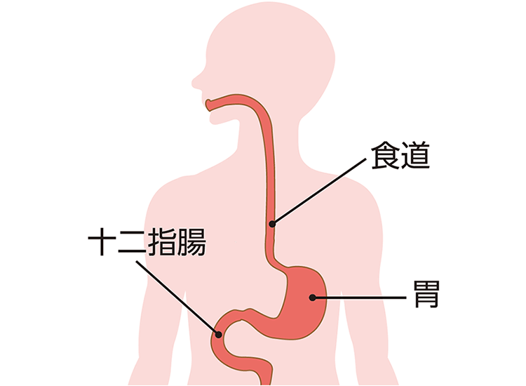 図