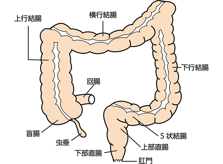 図