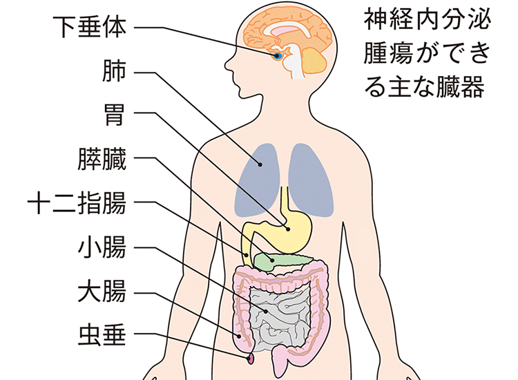 図