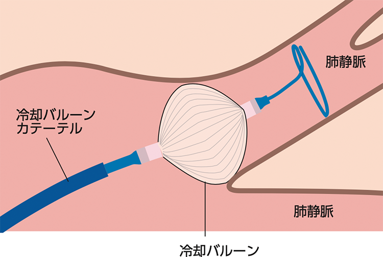 図