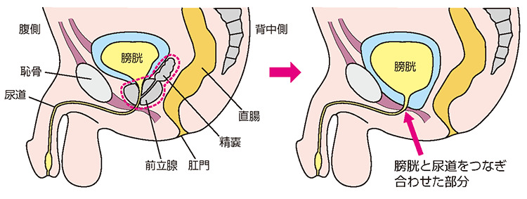その他の治療法