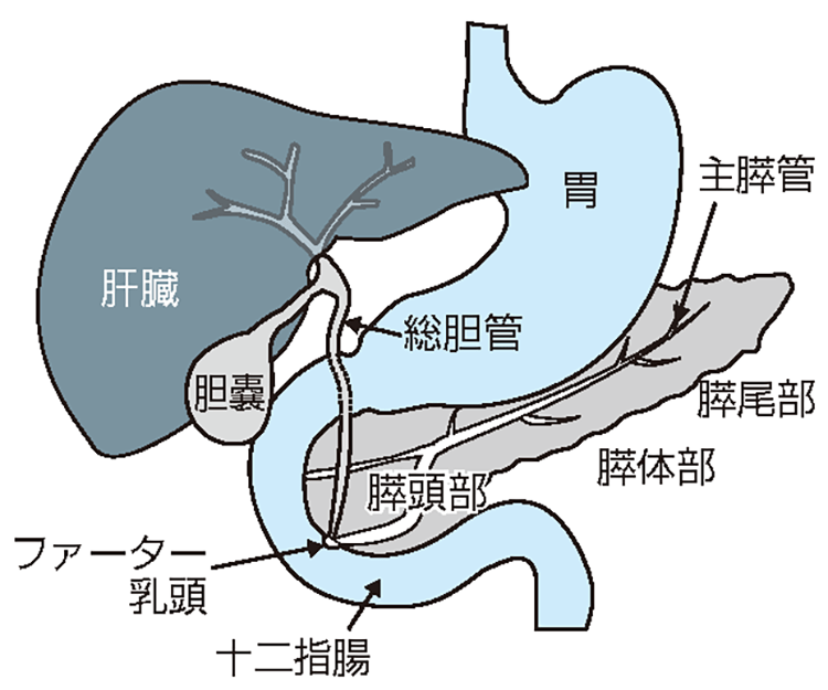 取り除く