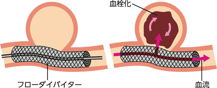 図