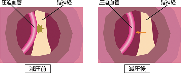 図