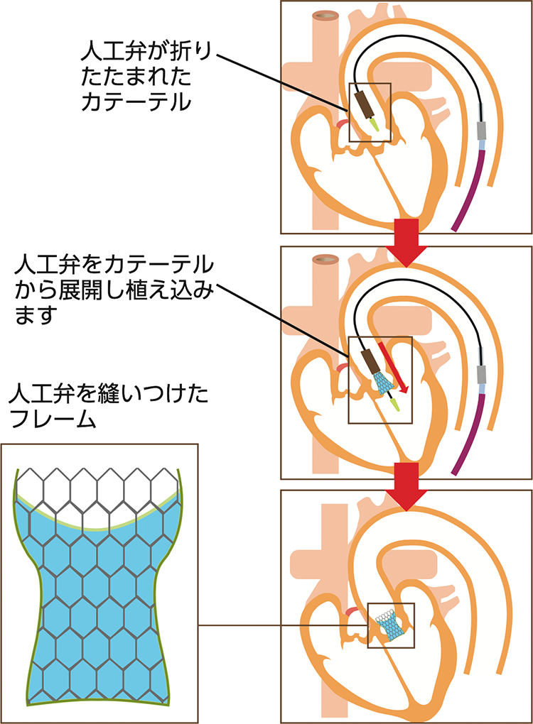 図