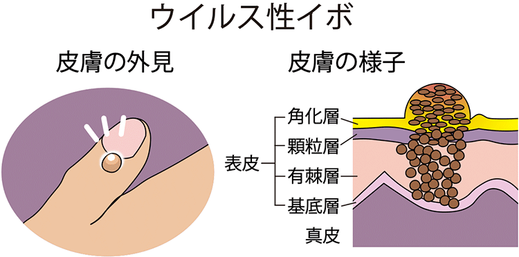 図