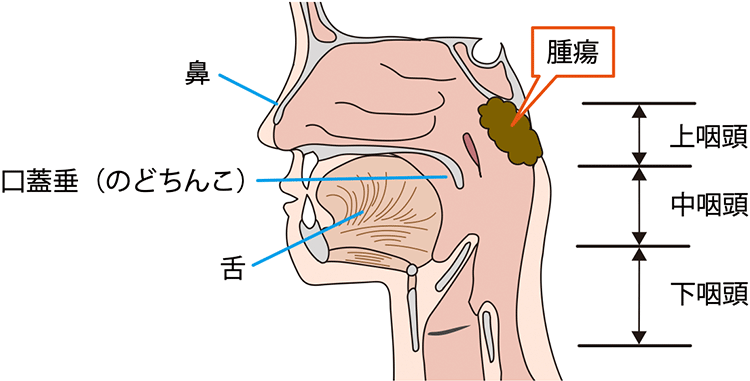 図