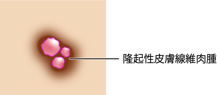 図