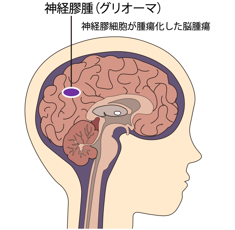 図