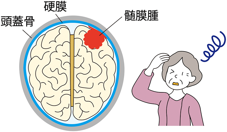 図