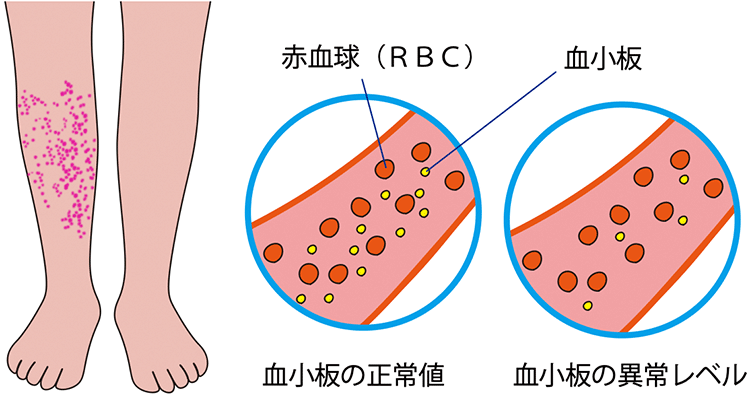 図