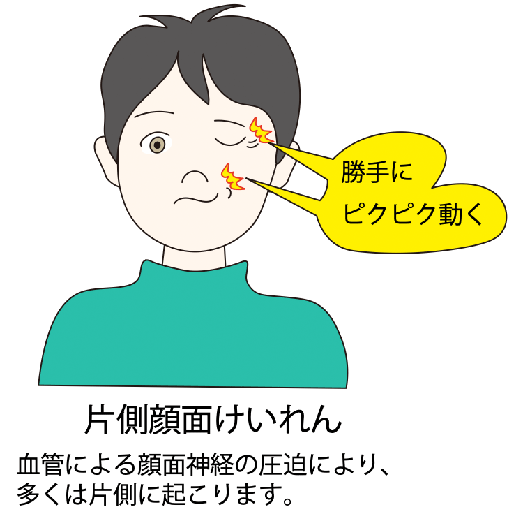 図