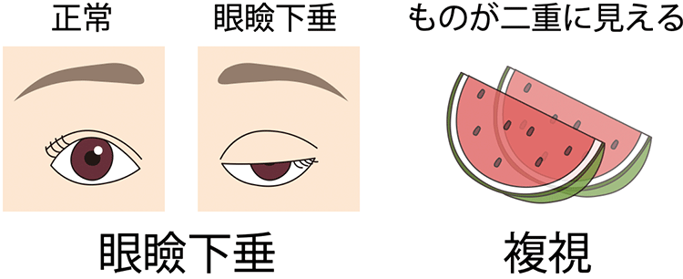 図