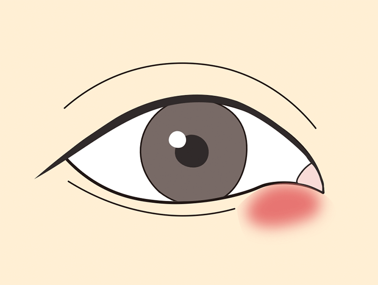 図