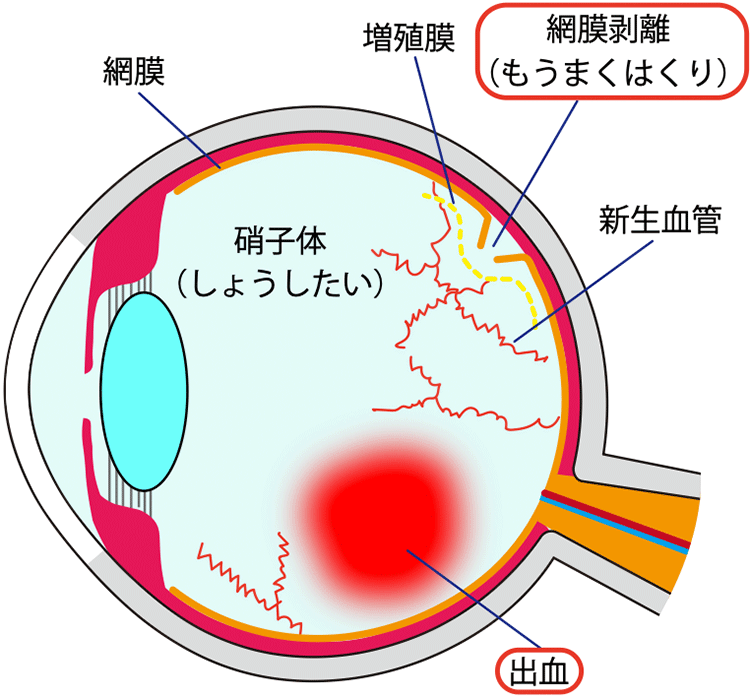 図